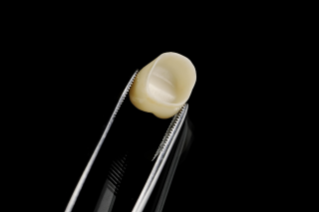 Result of dental milling machine work
